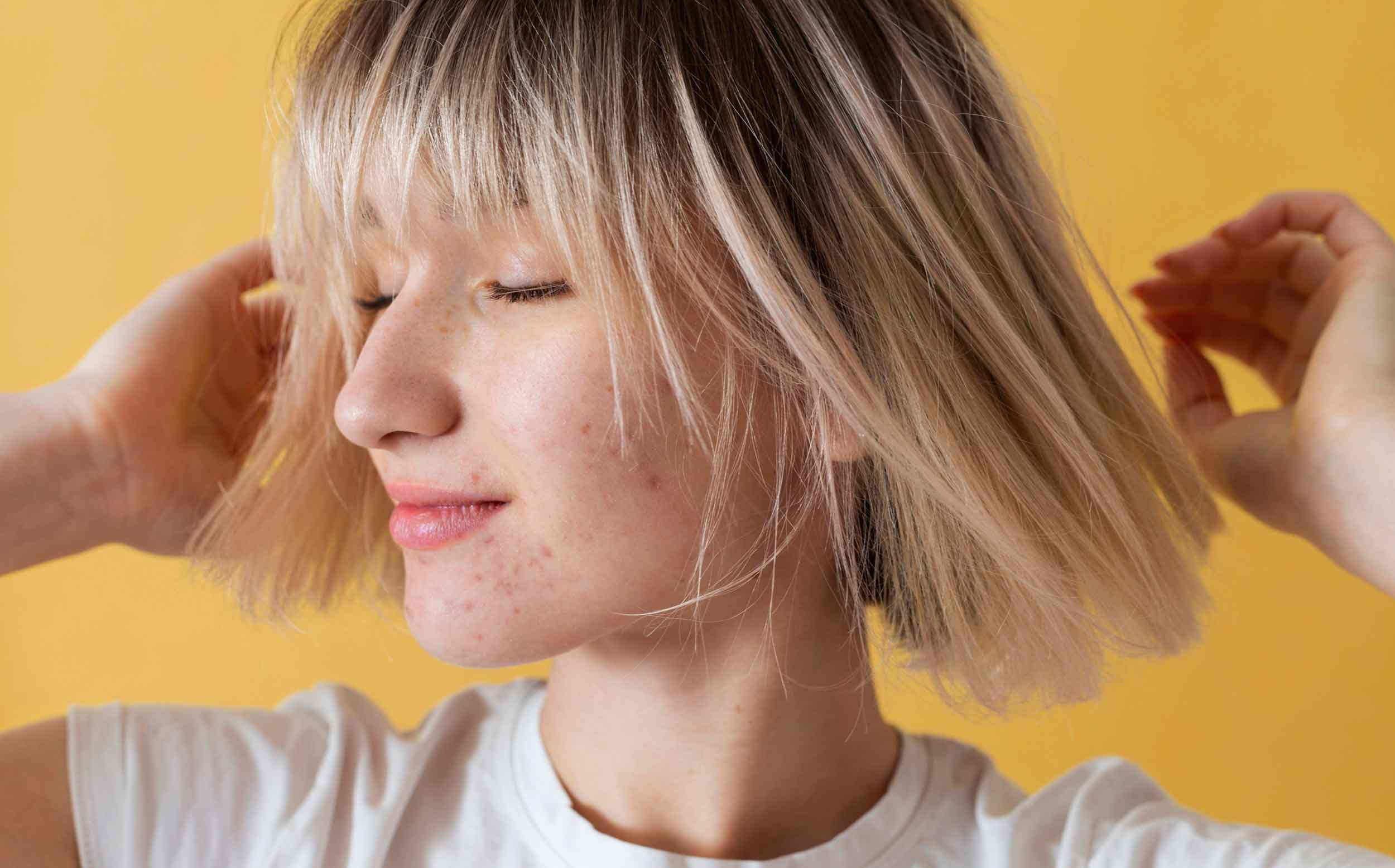 acne rentree adolescent routine soin